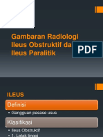 Gambaran Radiologi Ileus