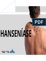 17 - Hanseniase PDF