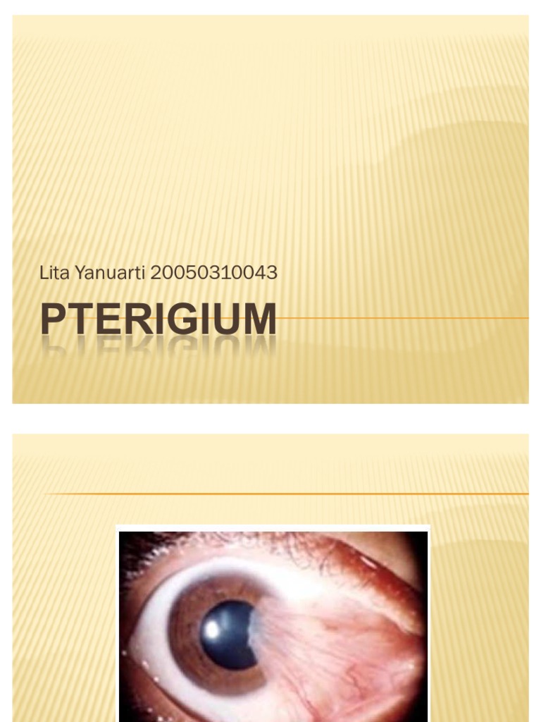 PTERIGIUM