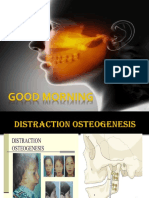 Distraction Osteogenesis