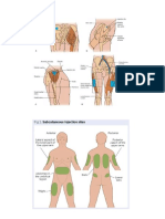 Sites of Injection