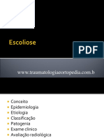 escoliose