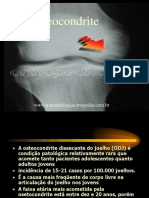 OSTEOCONDRITE dissecante do joelho