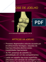 Artrose de Joelho