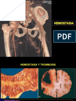 MEDICINA_SANGRE_Hemostasia_y_COAGULACI_N.ppt;filename_= UTF-8''MEDICINA%20SANGRE%20Hemostasia%20y%20COAGULACI%C3%93N-1.ppt