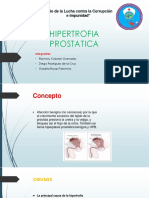 Hipertrofia Prostatica