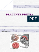 06 Placenta Previa