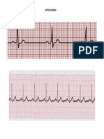 Latihan Ekg