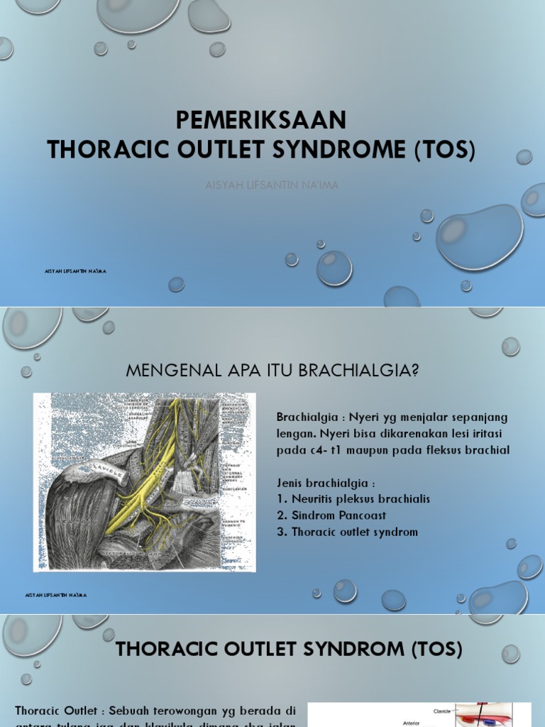 Pemeriksaan Thoracic Outlet Syndrome (Tos) : Aisyah Lifsantin Na'Ima | PDF