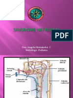 4.1 Sindrome Nefritico Angela