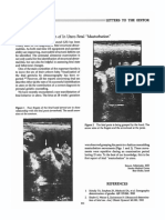 Sonographic Observation of in Utero Fetal "Masturbation": - Letters To The Editor