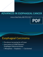 Esophageal Cancer by Dr. Dela Pena