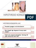 Hipotiroid Kongenital Mu