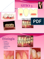 Sitio 3
