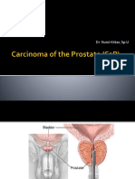 Carcinoma of the Prostate (CaP).pptx