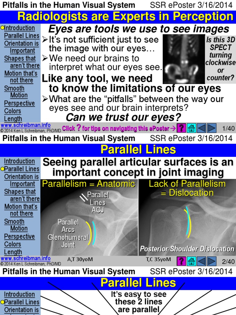 Radiologists Are Experts in Perception: Eyes Are Tools We Use To See ...