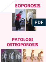 Osteoporosis 2