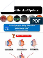 Panuveitis SAARC - PPT (Autosaved)