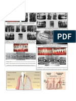 gambaran Radiologi Sk 3