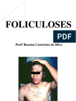 Acnes Foliculoses