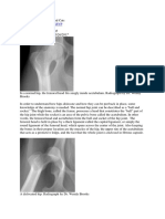 Hip Dislocation in Dogs and Cats (Wendy Brooks, DVM)