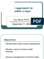 An Approach To Ankle X-Rays: Aric Storck PGY2 September 11, 2003