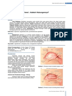 Hipertensi dan epistaksis.pdf