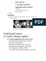 Risk Factor of Small Bowel Cancer in Crohn PT