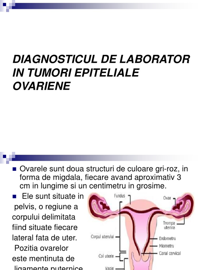 Cancer Ovarian | PDF