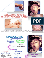 Alumna: Huirse Garcia Anaflavia: Coqueluche. Difteria. Tetanos, Paralisis Flacida