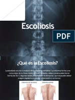 Escoliosis 110916104017 Phpapp01 Convertido