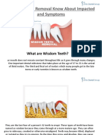 Wisdom Teeth Removal Know About Impacted Symptoms