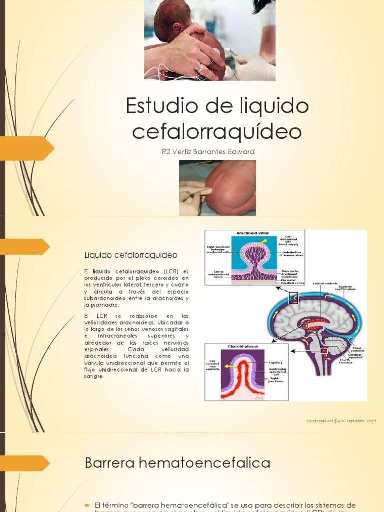 estudio-del-l-quido-cefalorraqu-deo-pdf-fluido-cerebroespinal