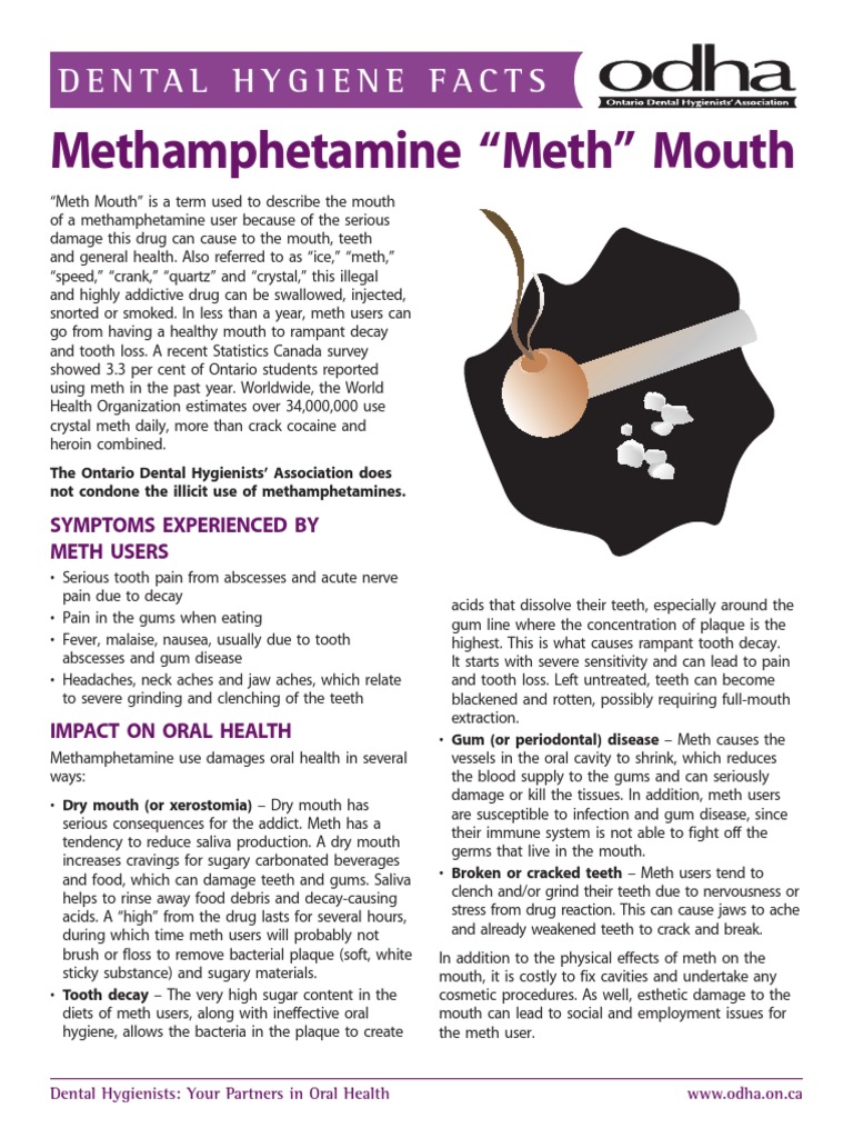 2016 ODHA Dental Hygiene Facts MethMouth141Final PDF Oral