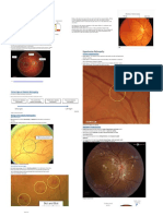 Funduscopy of Retinal Pathologies