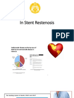 In Stent Restenosis