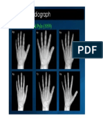 Hand Wrist Radiograph (Greulich and Pyle)