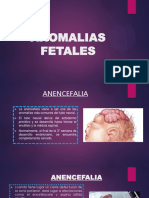 Anomalias Fetales