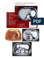 Anatomia Abdominal e Afecções Hepáticas