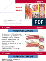 13 Clase Enf y Farmacoter.arteriesclerosis- Angina de Pecho (2)