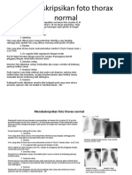 Mendeskripsikan Foto Thorax Normal
