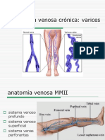 Insuficiencia Venosa