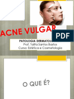 Acne Vulgar