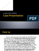 Subdural Hematoma