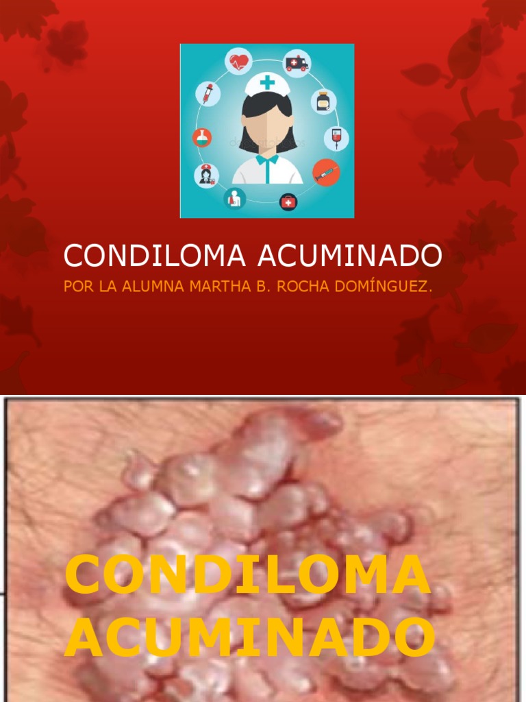 Tipos y características del condiloma acuminado | PDF | Especialidades ...