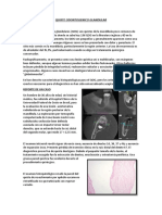 Quiste Odontogenico Glandular