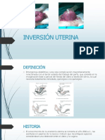 Inversion Uterina