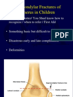 Pediatric Elbow Fractures Guide
