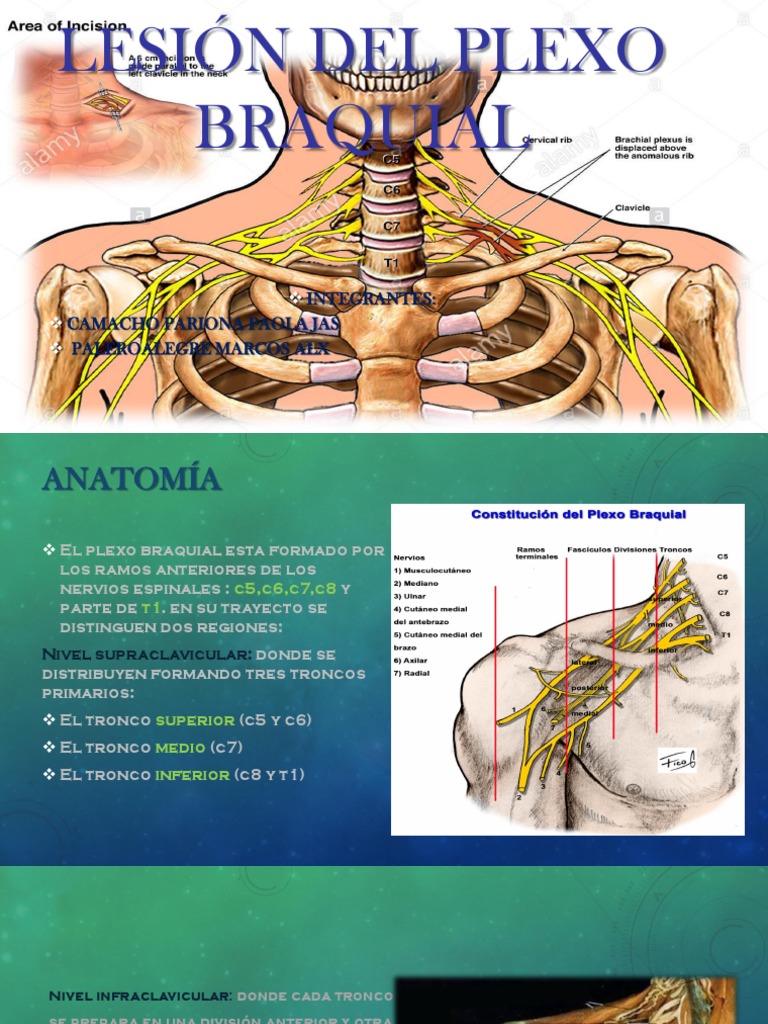 Lesion Del Plexo Braquial Pdf Sistema Musculoesquelético Anatomía