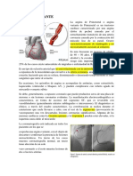 Angina Variante